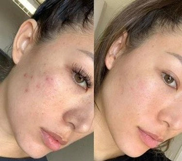 HIGH-FREQUENCY BEAUTY WAND