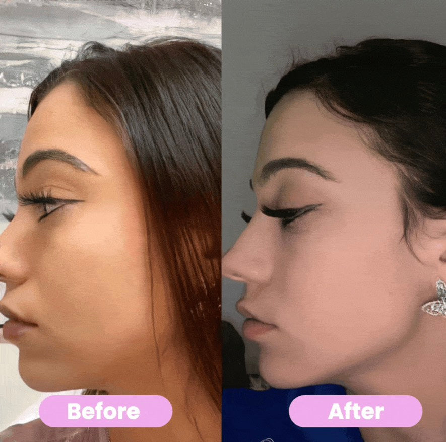 7-IN-1 LED FACIAL SCULPTOR