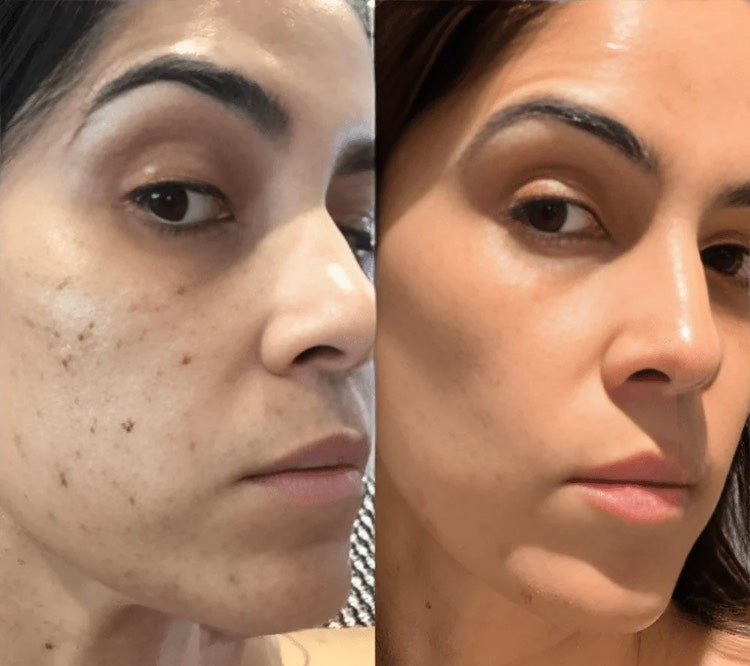HIGH-FREQUENCY BEAUTY WAND