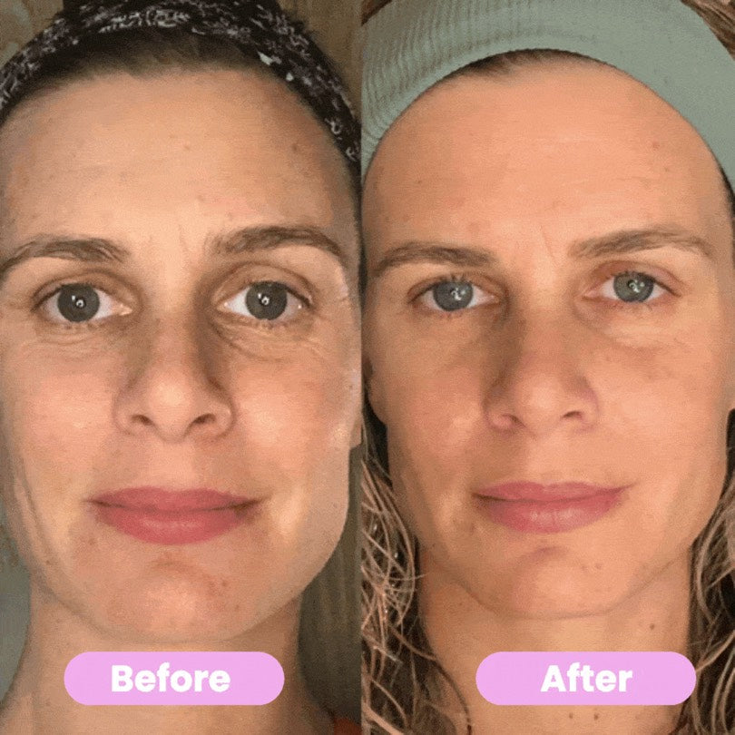7-IN-1 LED FACIAL SCULPTOR
