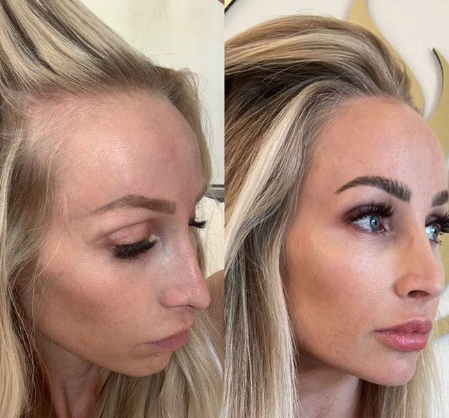 HIGH-FREQUENCY BEAUTY WAND