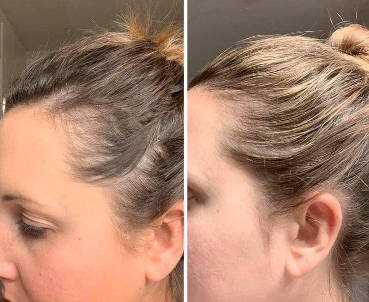 HIGH-FREQUENCY BEAUTY WAND